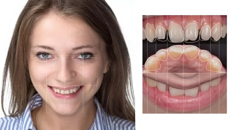 Лечение ,  протезирование и имплантация зубов в Полтаве на выгодных усл 2